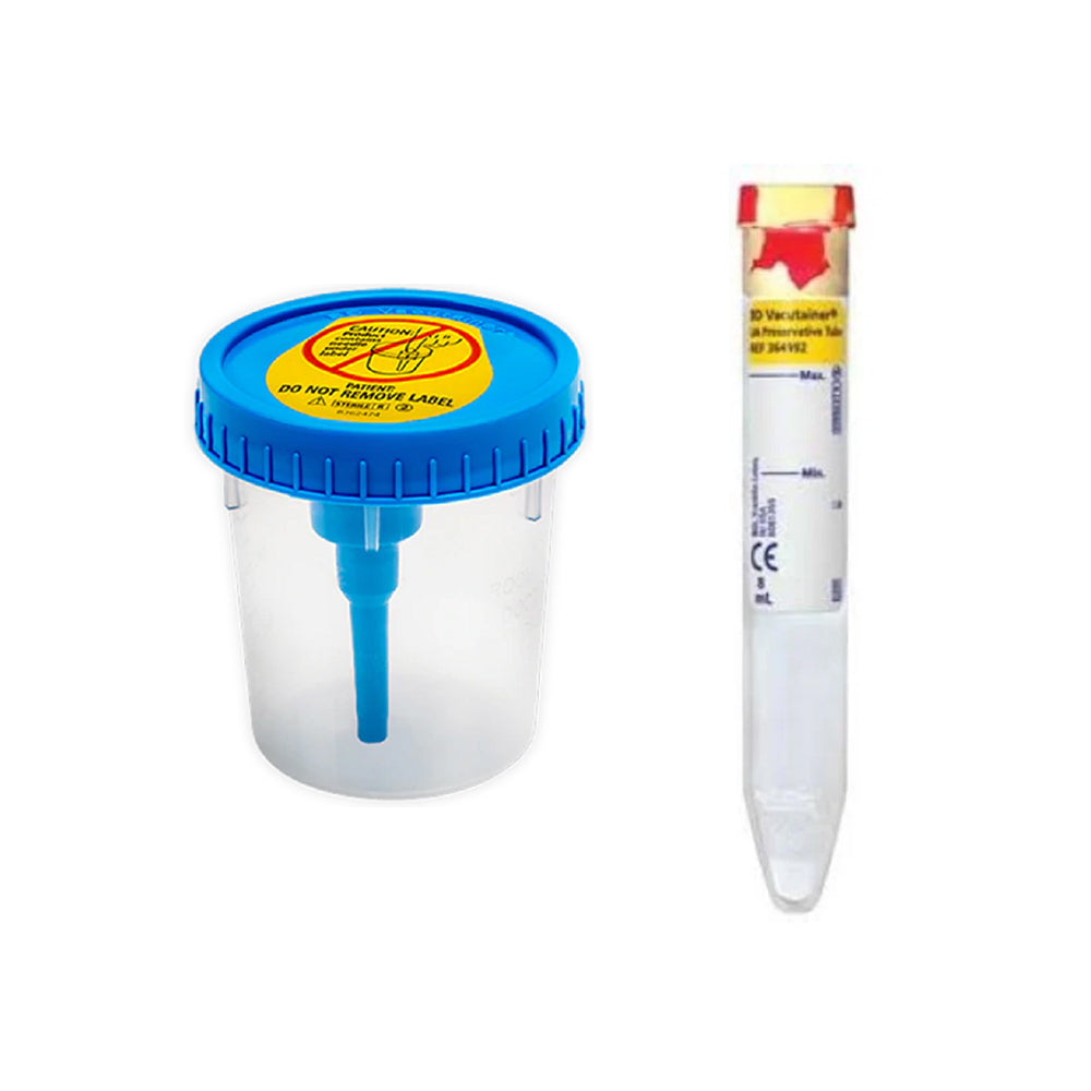 Urinalysis cup And 8mL BD Vacutainer Urine Collection Tube(Red/Yellow)