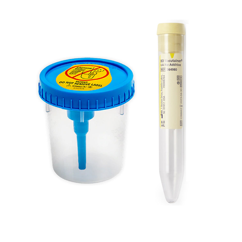Urinalysis cup And 8mL BD Vacutainer Urine Collection Tube(Yellow)