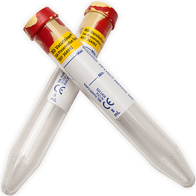 8mL BD Vacutainer Plastic Urinalysis Tubes (Red/Yellow)